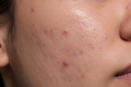 Explore by skin concern